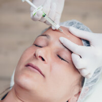 Faltenunterspritzung mit Hyalyron