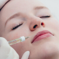 Volumenaufbau der Lippen mit Hyalyron