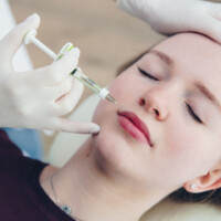 Volumenaufbau der Lippen mit Hyalyron