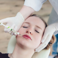 Volumenaufbau der Lippen mit Hyalyron