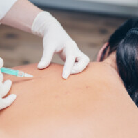 Neuraltherapie nach Huneke