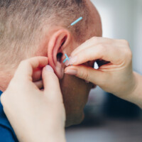 französische Ohrakupunktur