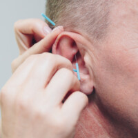 französische Ohrakupunktur